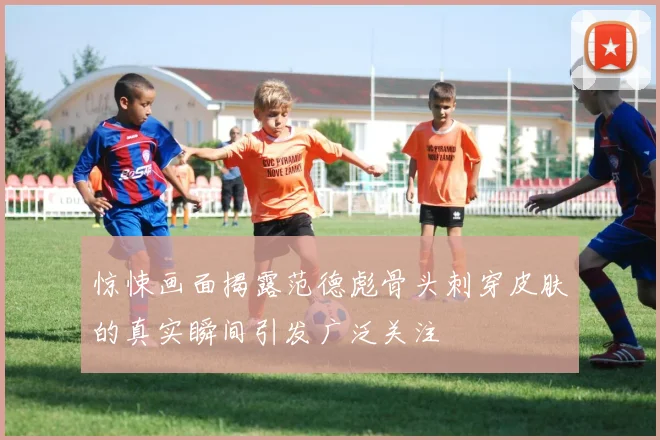 惊悚画面揭露范德彪骨头刺穿皮肤的真实瞬间引发广泛关注